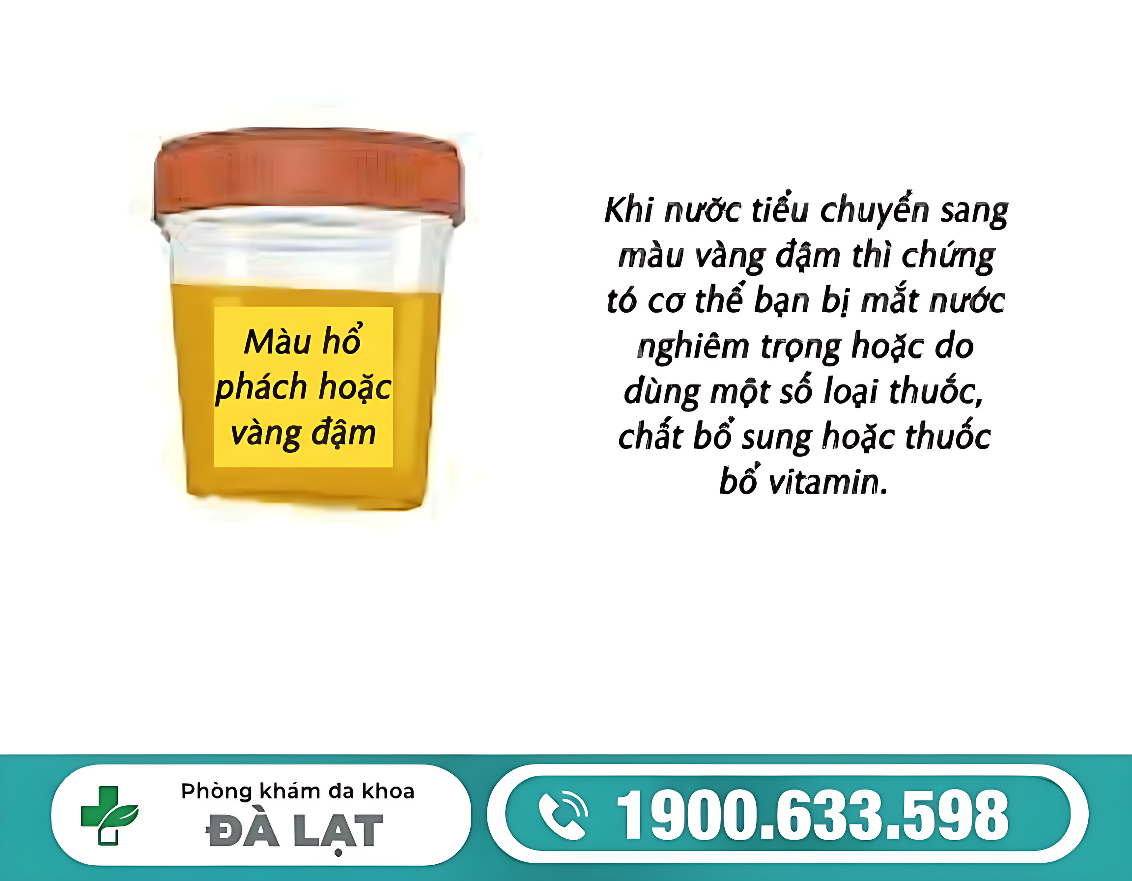 Hình ảnh minh họa